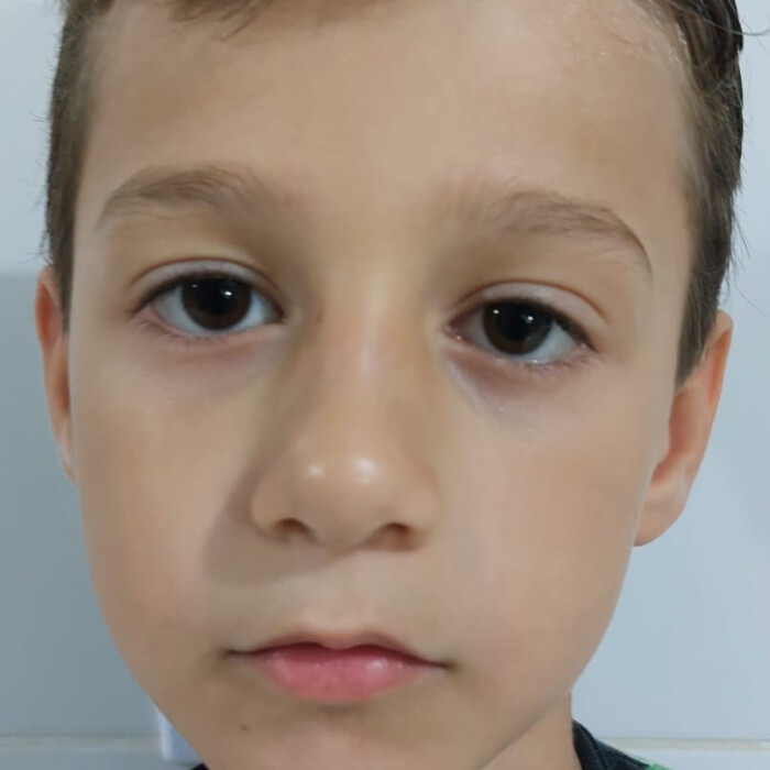 Arthur Miguel Alfenes